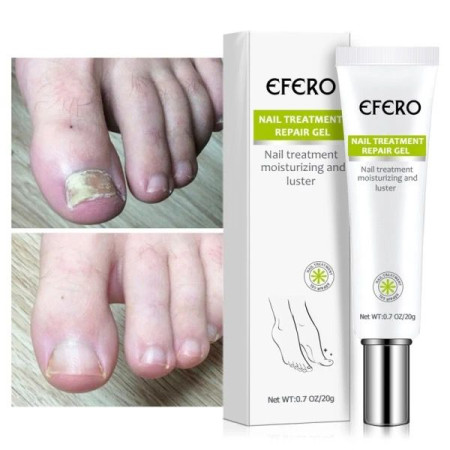 EFERO Nail Treatment Repair Gel