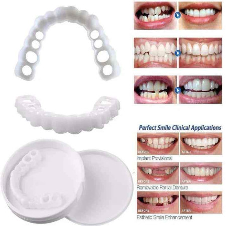 Snapon Smile Teeth