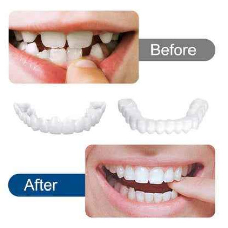 Snapon Smile Teeth